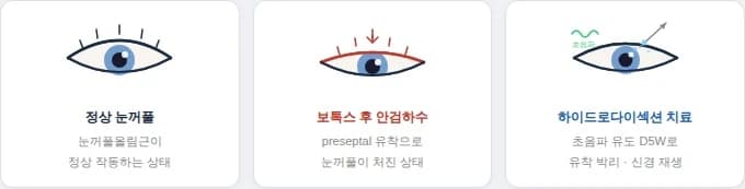 보톡스 후 눈꺼풀 처짐과 하이드로다이섹션 연구 — 원문 자료 2