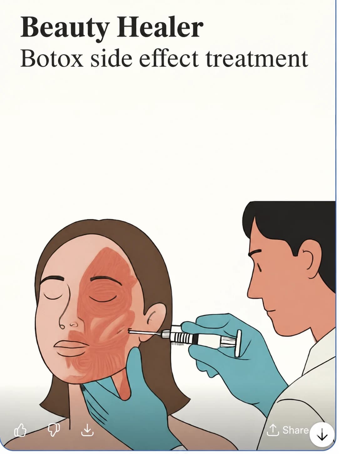 Source facial-injection illustration — AI-assisted English text adaptation; not an unedited medical original