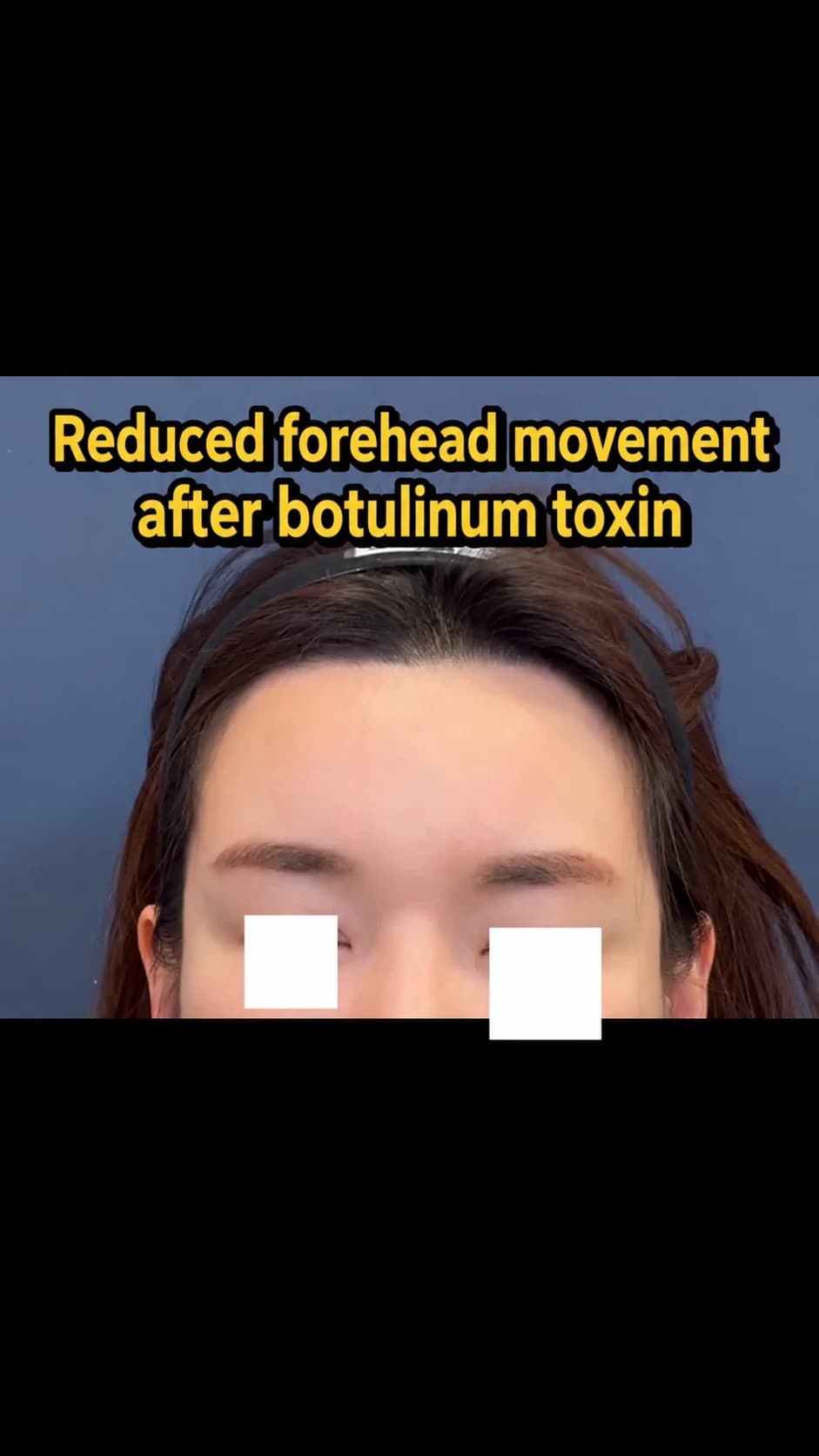 Source video poster