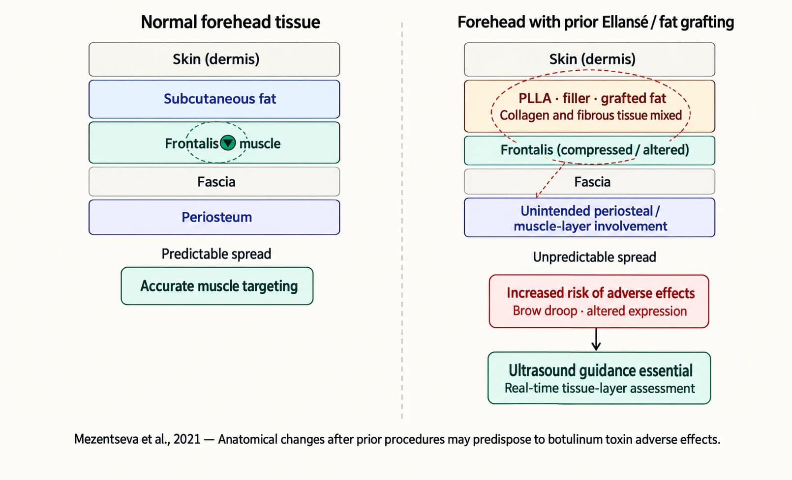 Source schematic comparing forehead tissue with prior treatment — material and anatomy review pending