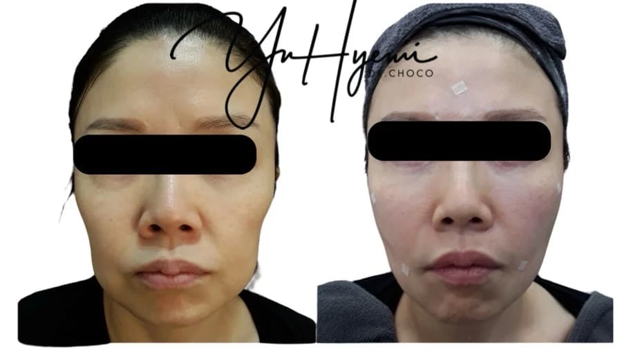 정면의 개별 환자 비교사진