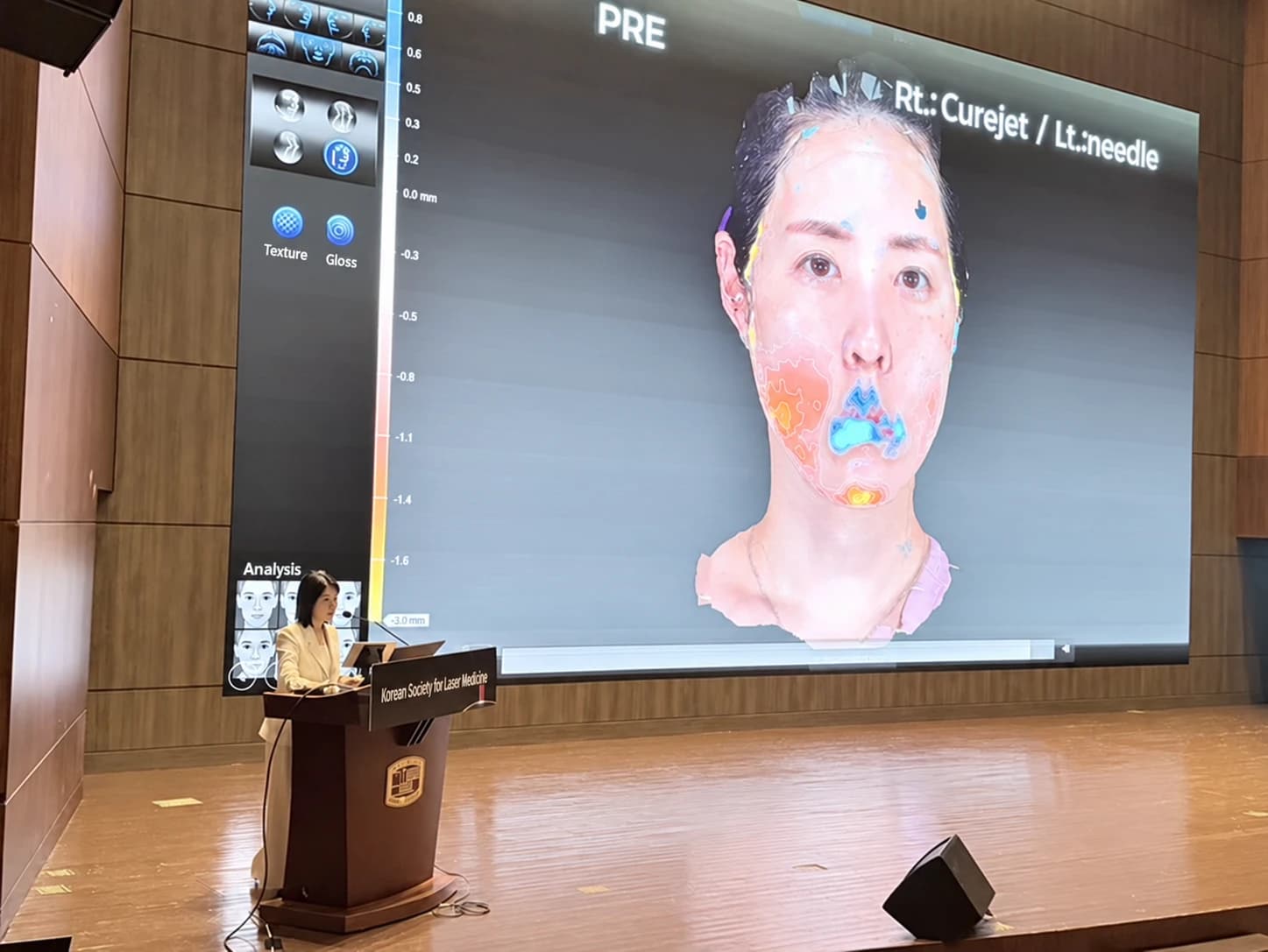 Presentation photograph of 3D imaging in the author’s CureJet and needle self-observation