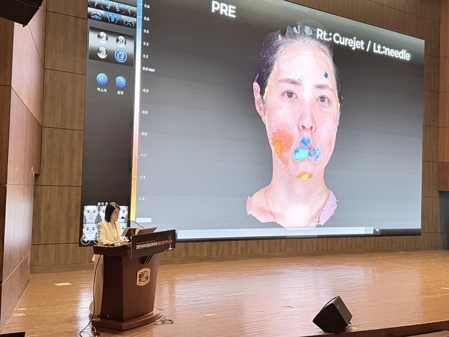 큐어젯과 바늘 주사 자가 관찰을 설명하는 3D 영상 발표 사진