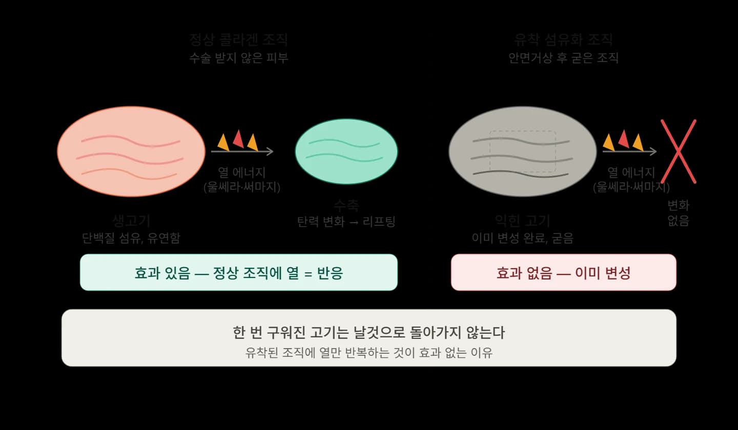 에너지 시술 후 조직 변화와 비유의 한계 — 원문 자료 1