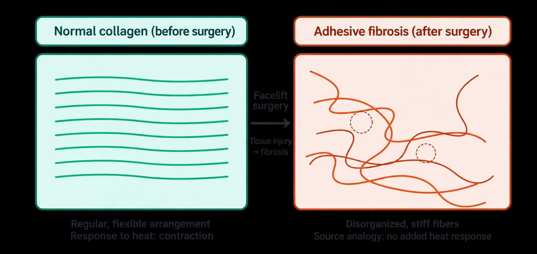 Tissue changes after energy treatments: limits of an analogy — source material 4 — AI-assisted English adaptation; not an unedited medical original