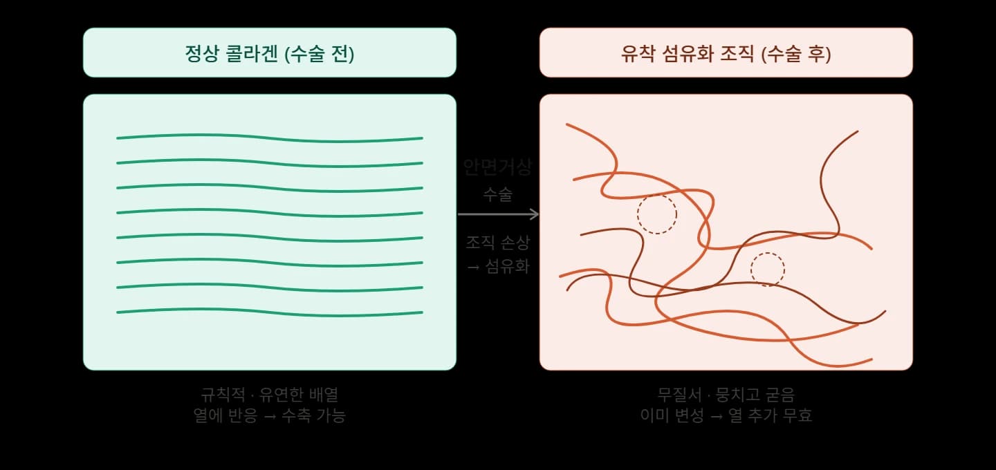 에너지 시술 후 조직 변화와 비유의 한계 — 원문 자료 4
