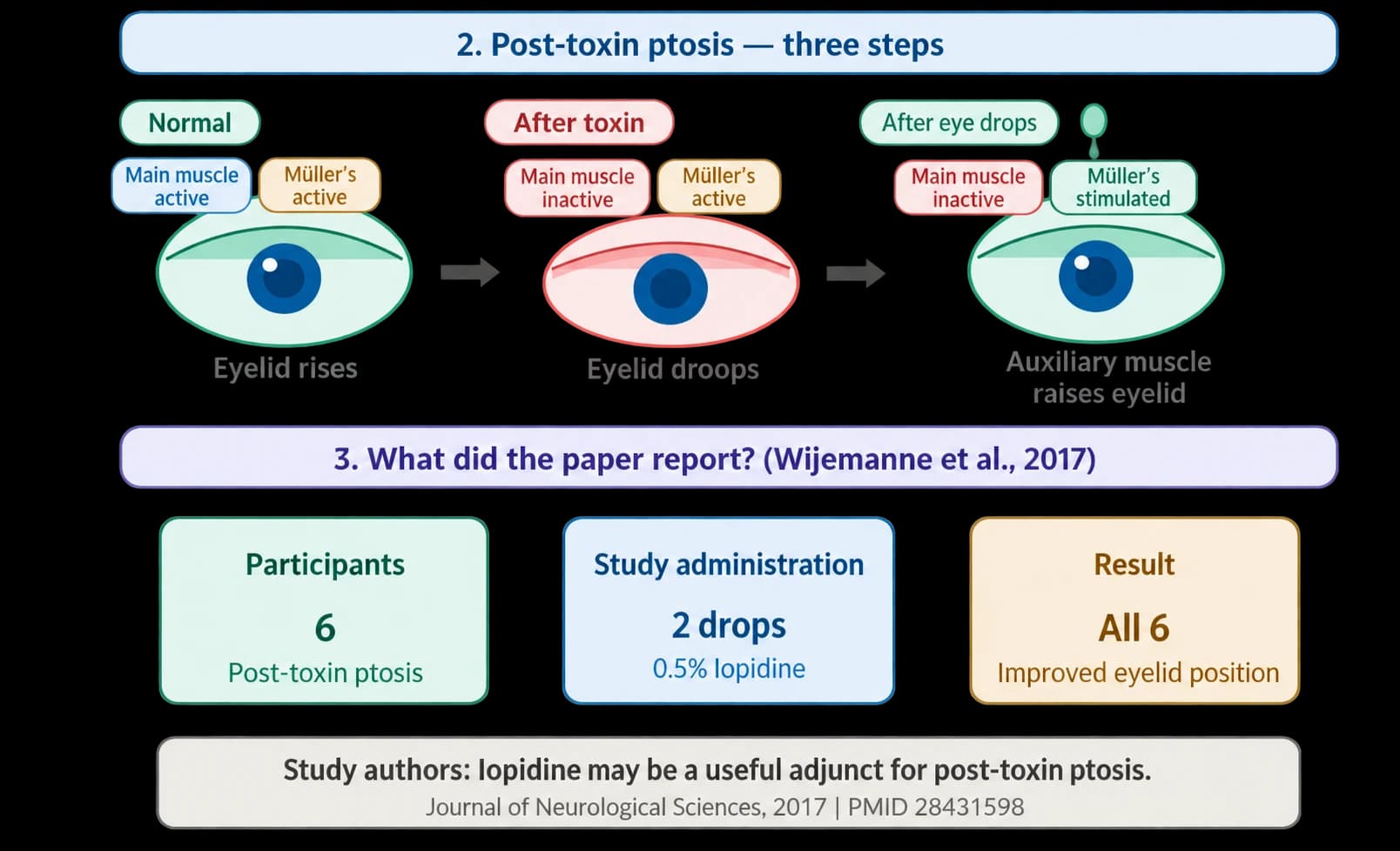 Eye-drop research for eyelid ptosis after botulinum toxin — source material 4 — AI-assisted English adaptation; not an unedited medical original