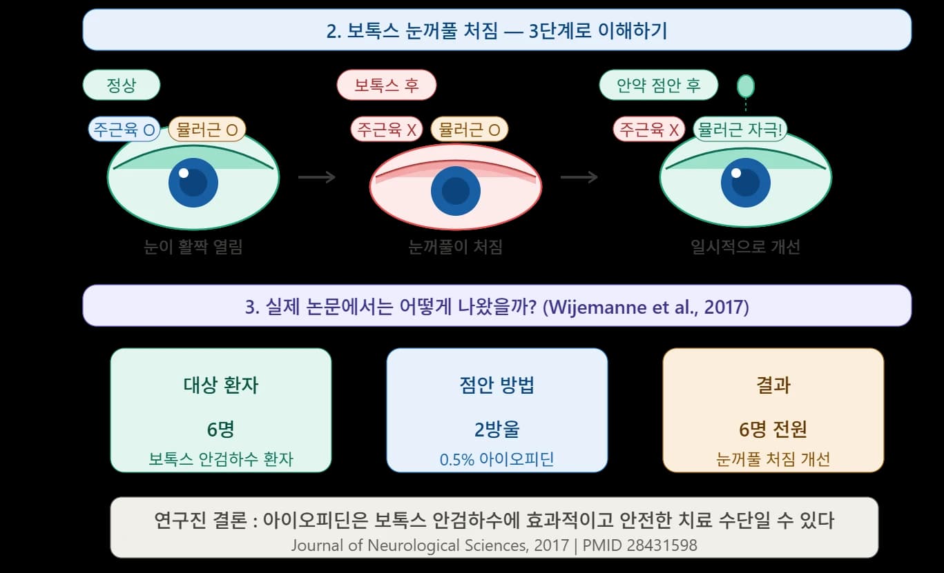 보톡스 후 눈꺼풀 처짐과 점안제 연구 — 원문 자료 4