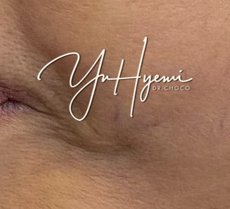 원문 개별 증례 사진 — 치료 경과·동의·재게시 승인 검수 대상