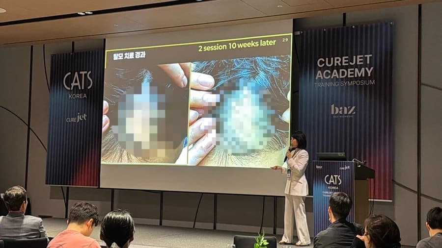 학회에서 모발 관련 사례를 설명하는 발표 장면