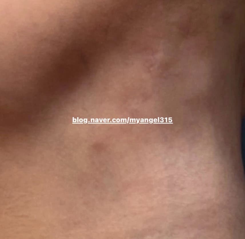 Individual source-case photograph — course, consent and republication require review