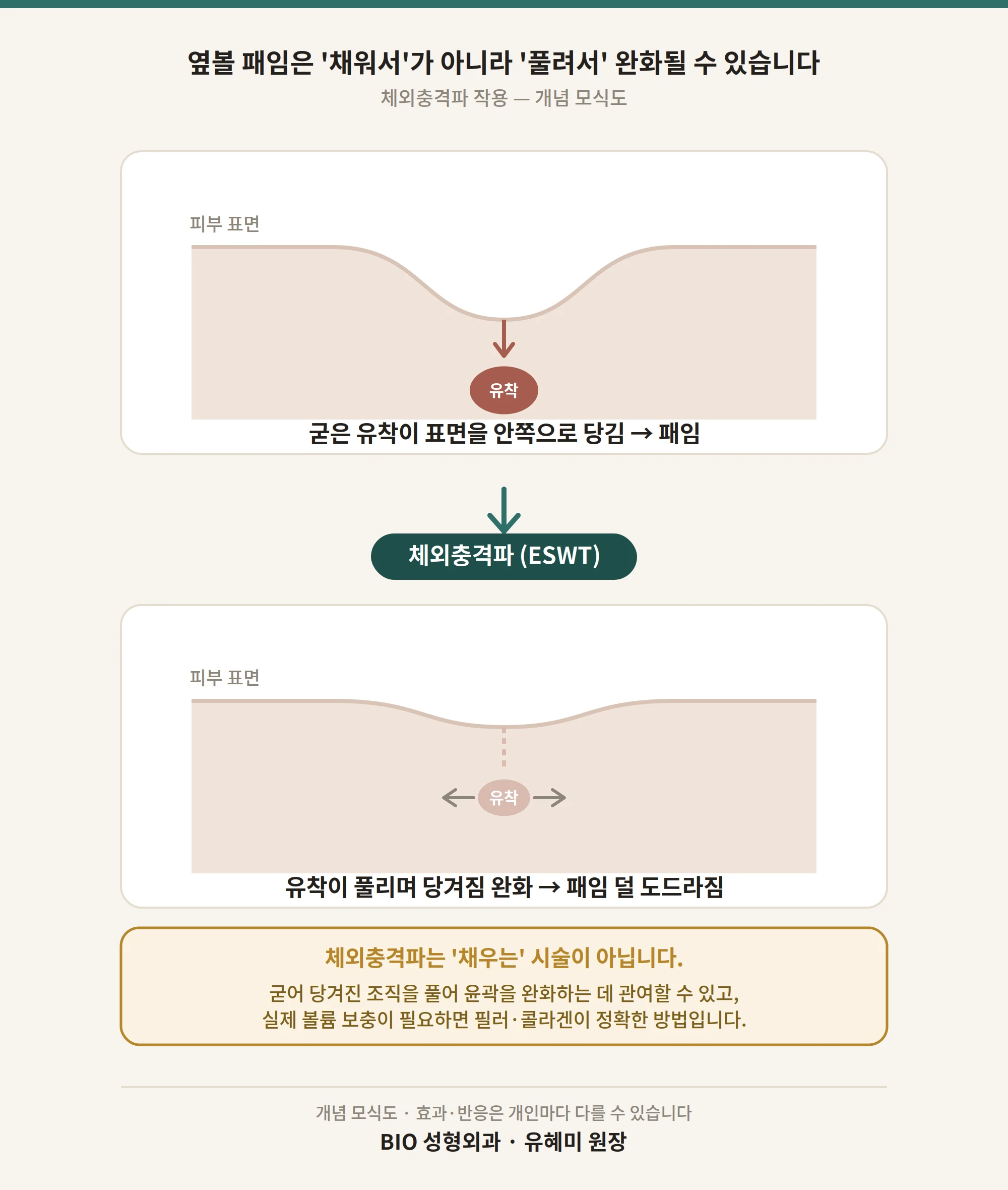 유착과 체외충격파의 관계를 설명하는 도표