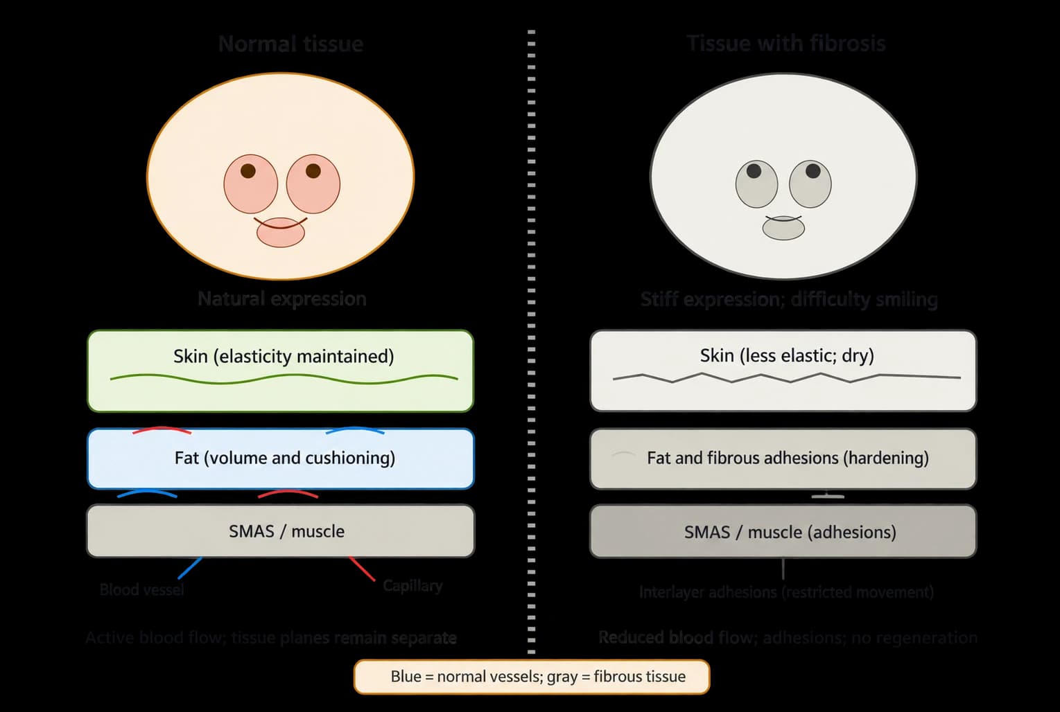 Source hypothesis diagram comparing tissue states — source hypothesis, not proof of causation or effectiveness — AI-assisted English text adaptation; not an unedited medical original