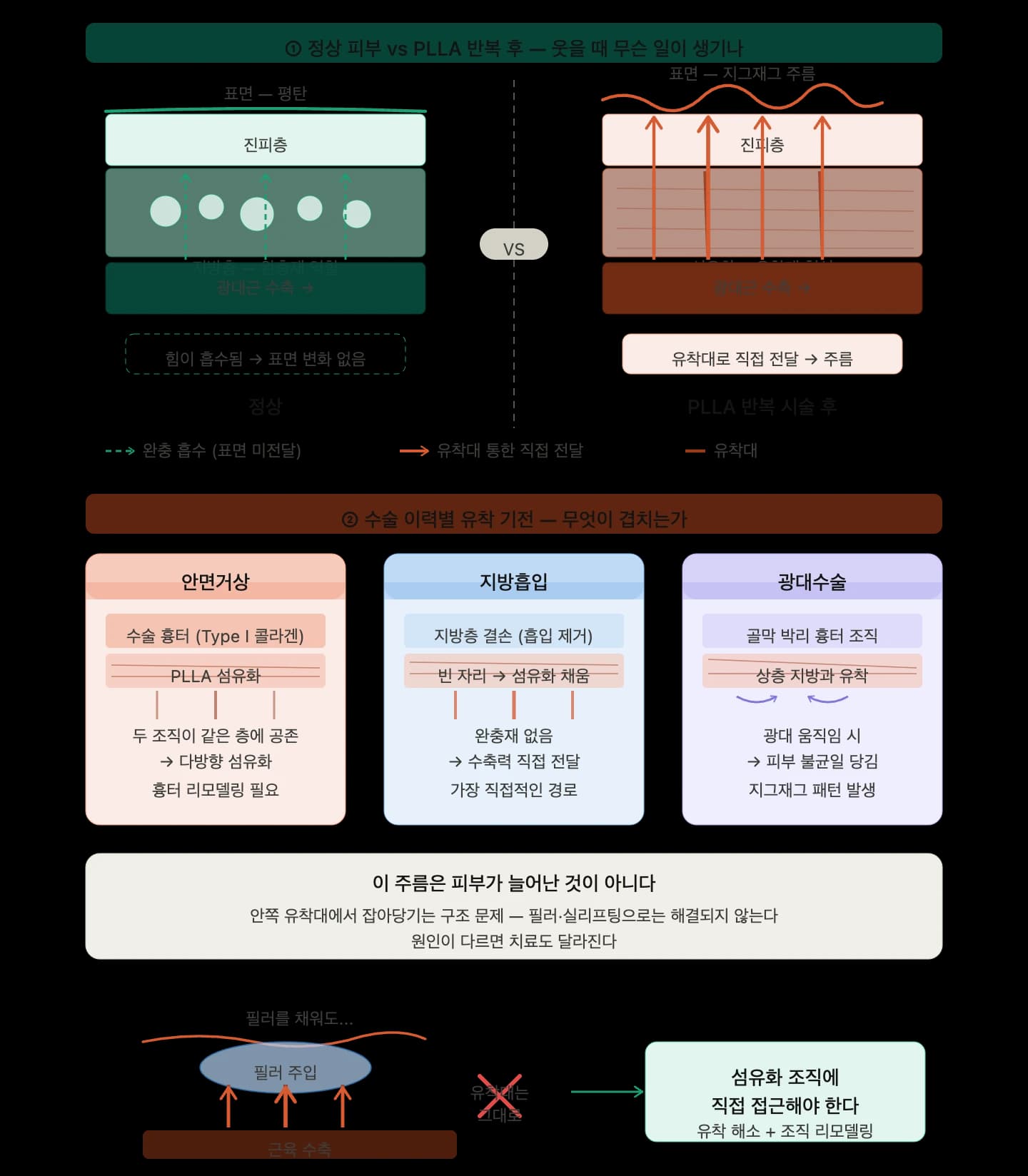 콜라겐 자극제 시술 후 팔자주름을 평가할 때 — 원문 자료 2