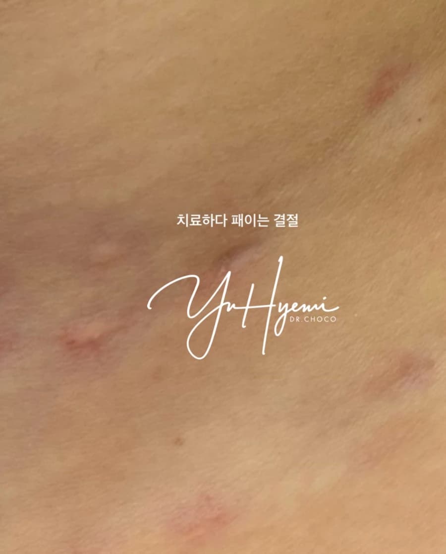 원문 개별 증례 사진 — 치료 경과·동의·재게시 승인 검수 대상