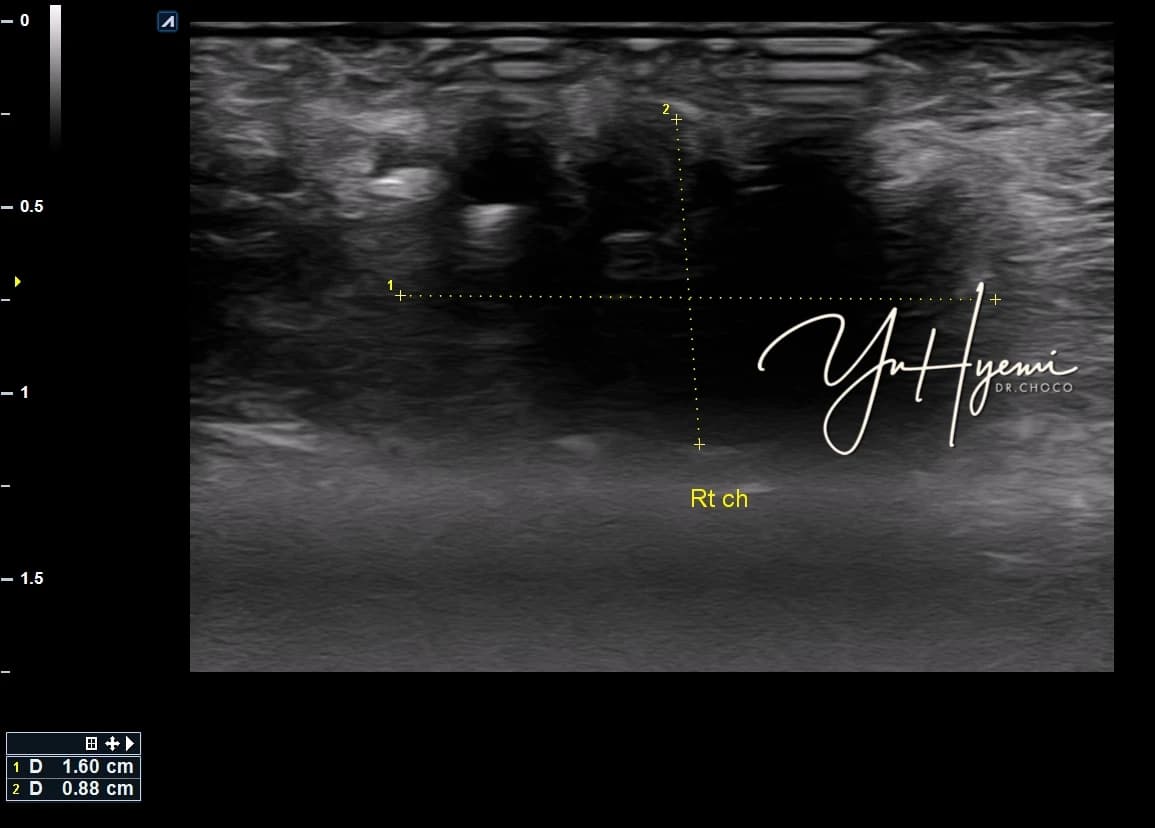 Individual ultrasound image