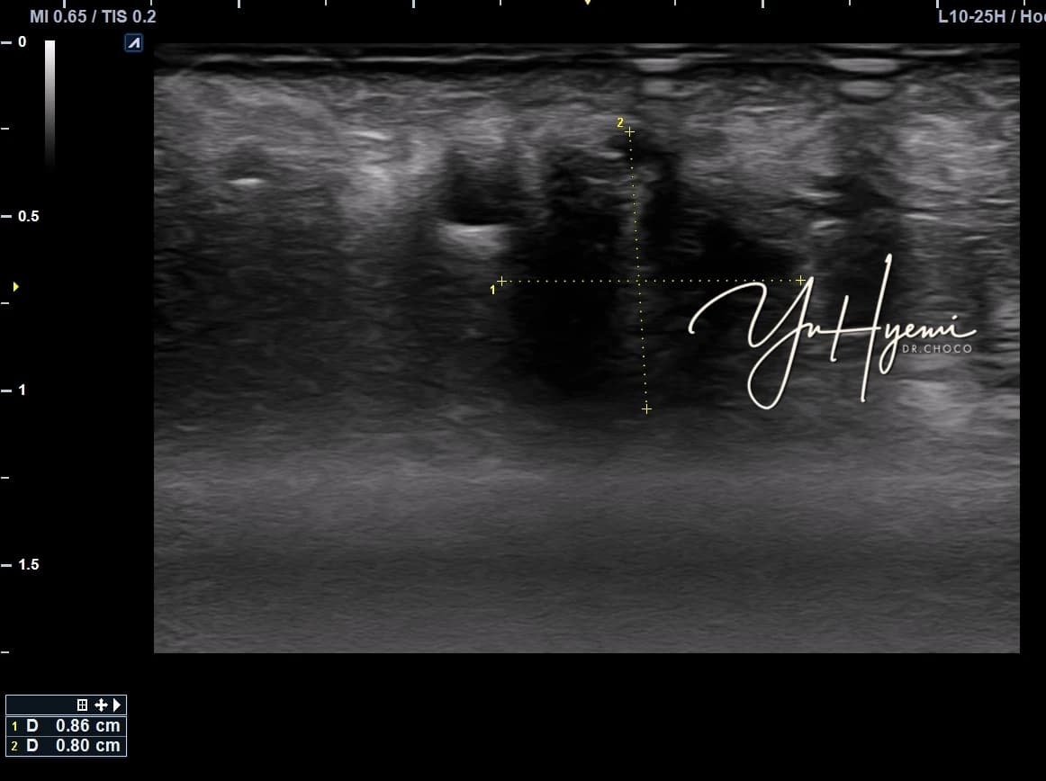 Individual ultrasound follow-up image