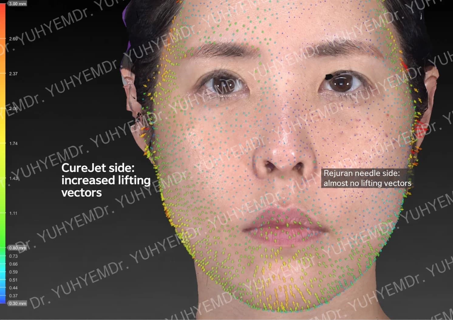 Personal 3D vector comparison