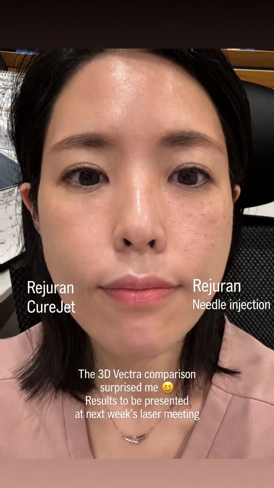 Delivery labels on opposite sides of the author’s face — AI-assisted English text adaptation; not an unedited medical original