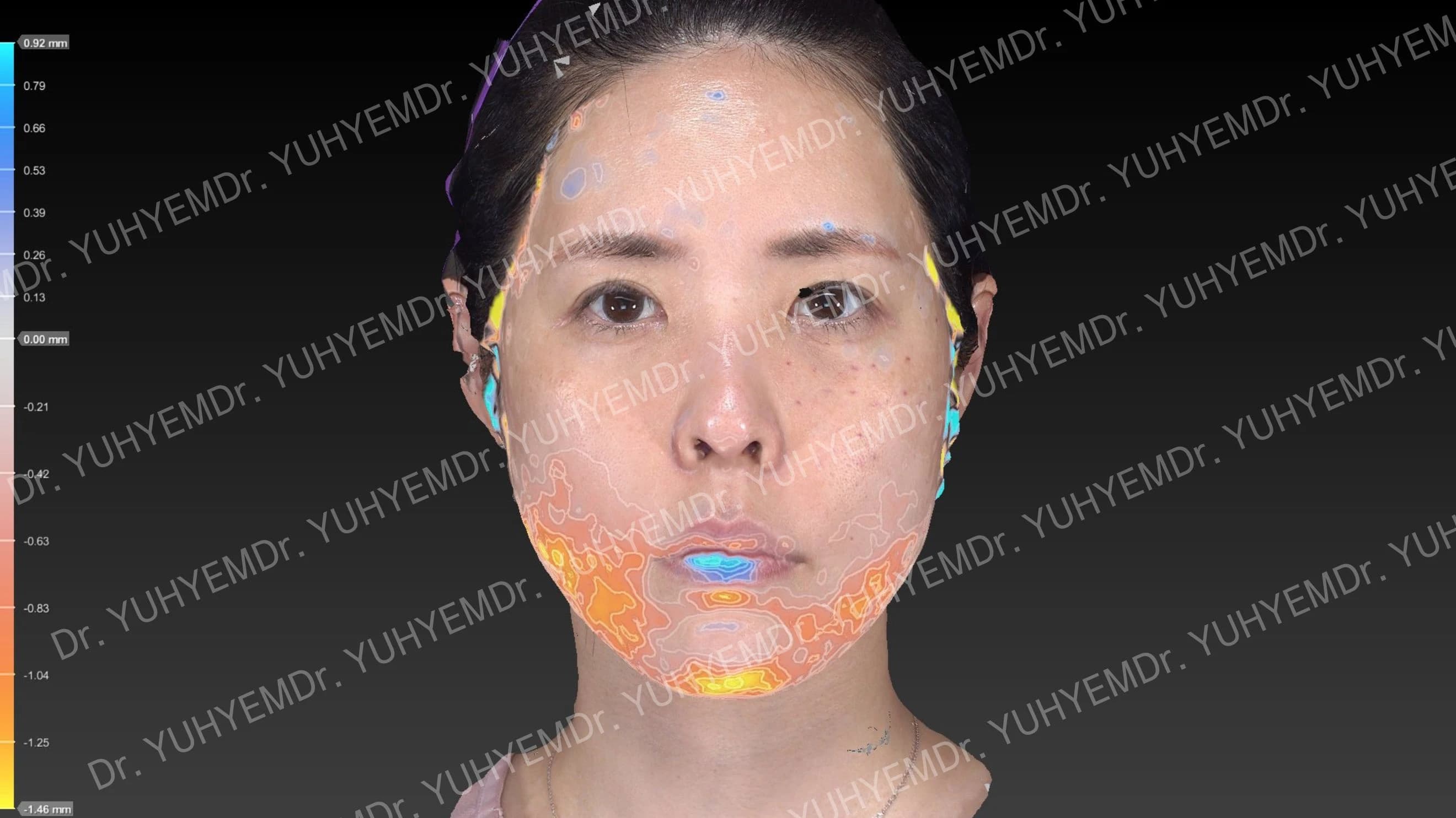 개인 3D 비교 자료
