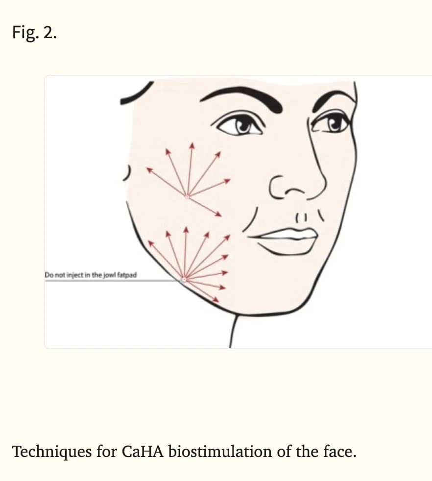 Source research figure on CaHA distribution — technical interpretation requires review