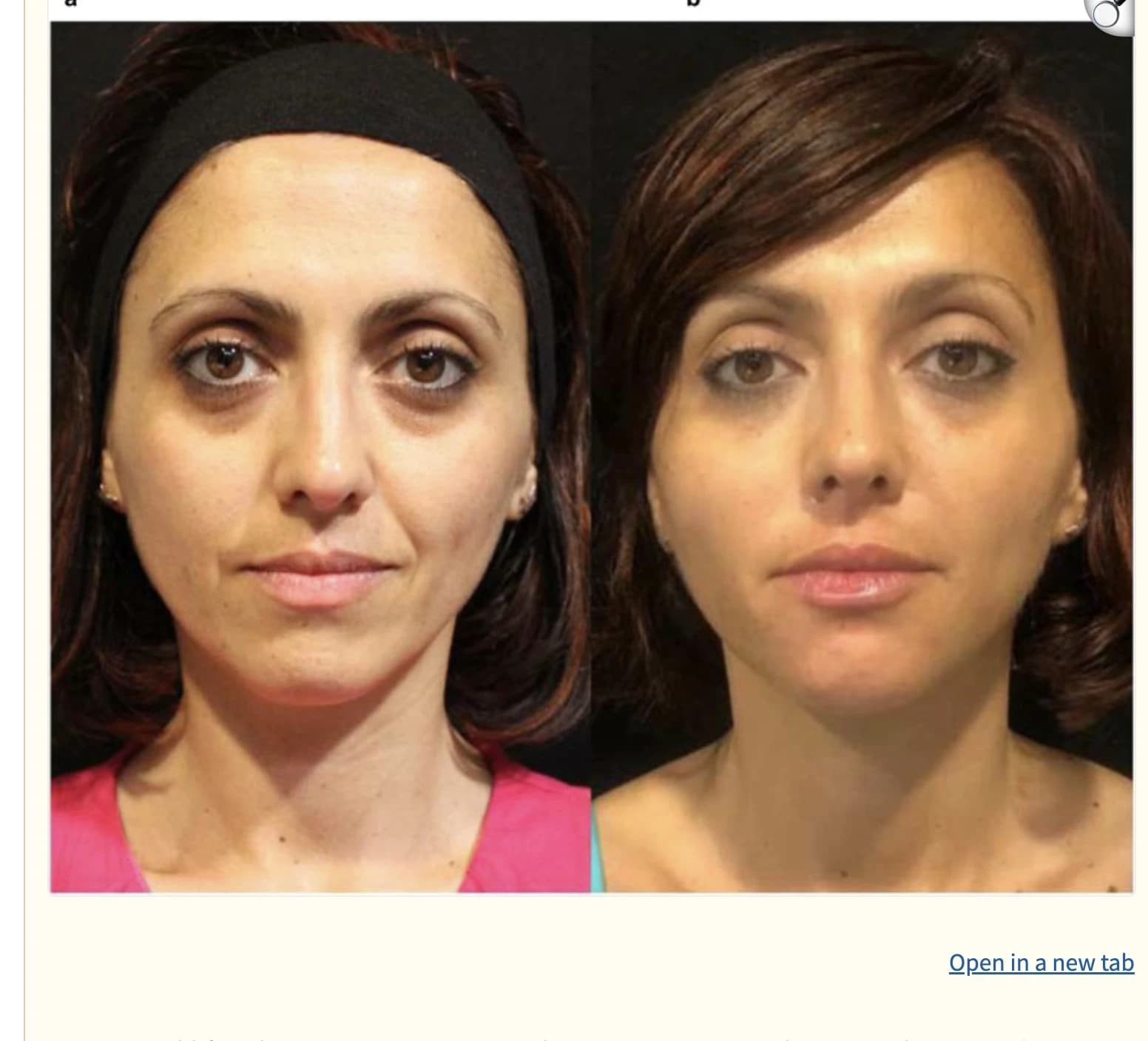 Individual-case comparison photograph from the source literature