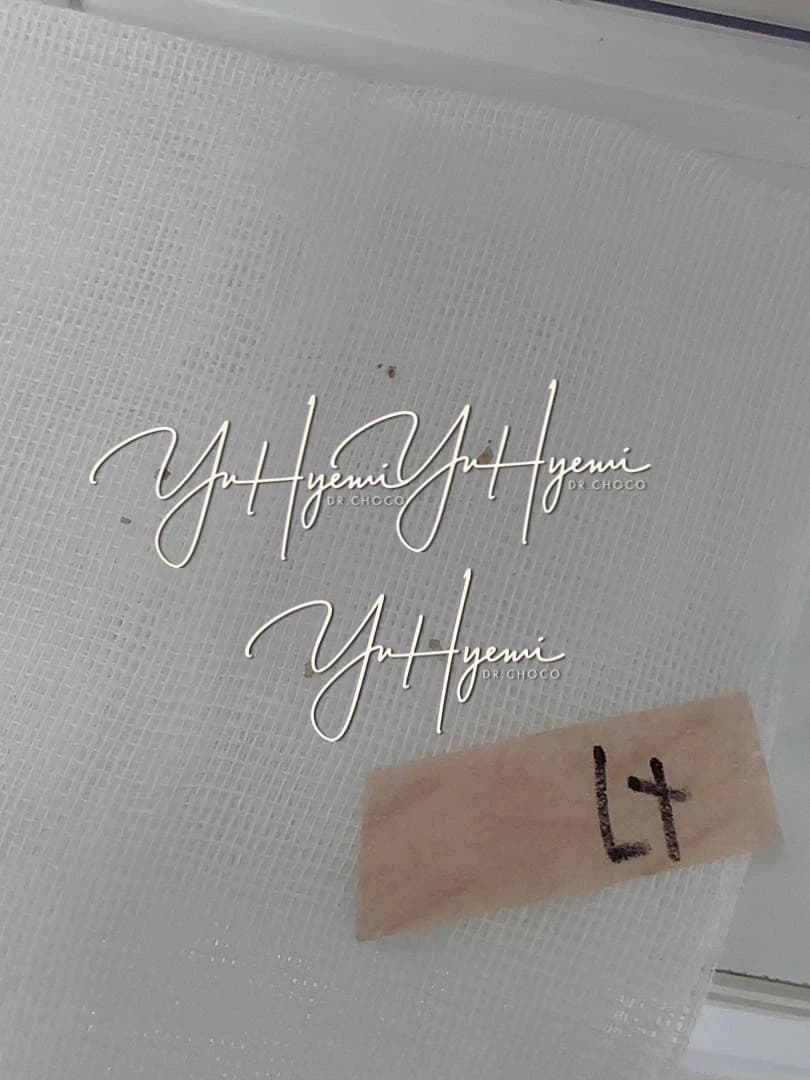 원문 결절 제거 사례에서 촬영한 조직 사진