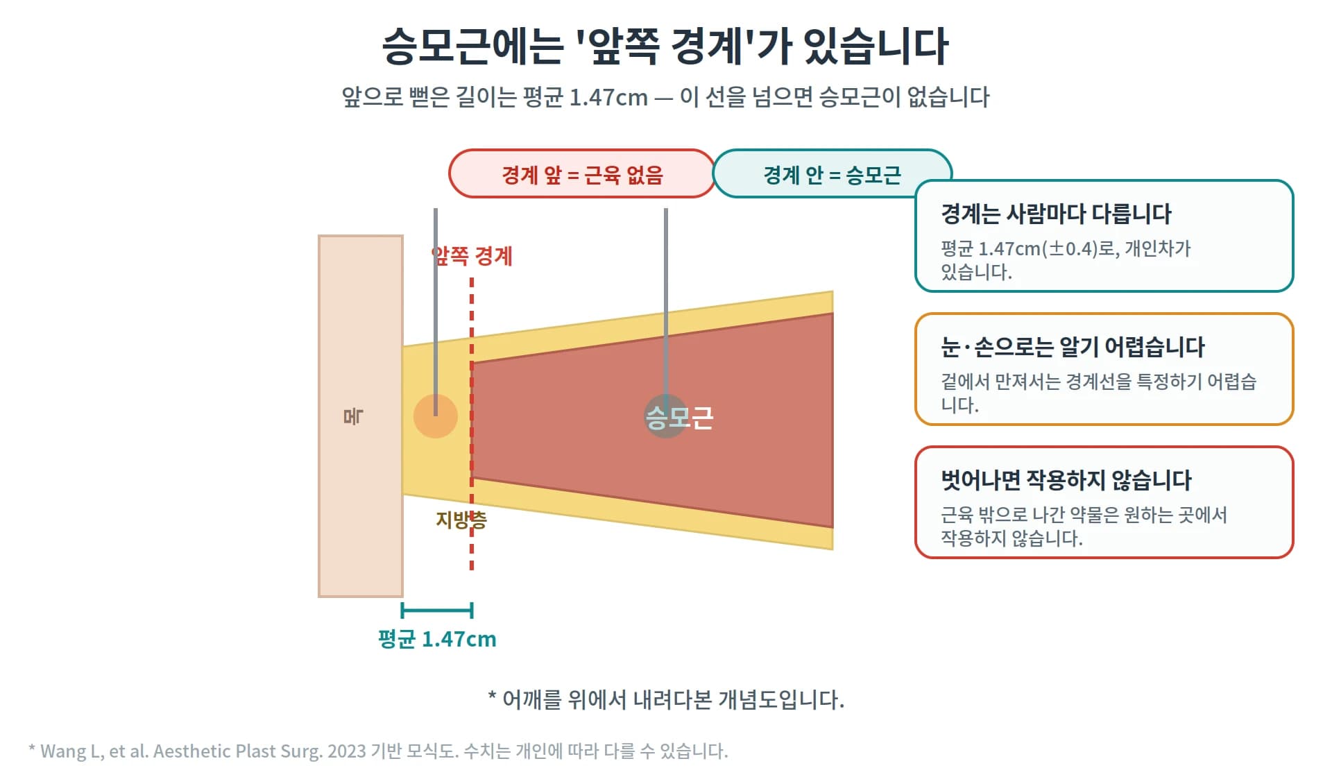 승모근 앞쪽 경계와 조직 두께를 설명하는 도해
