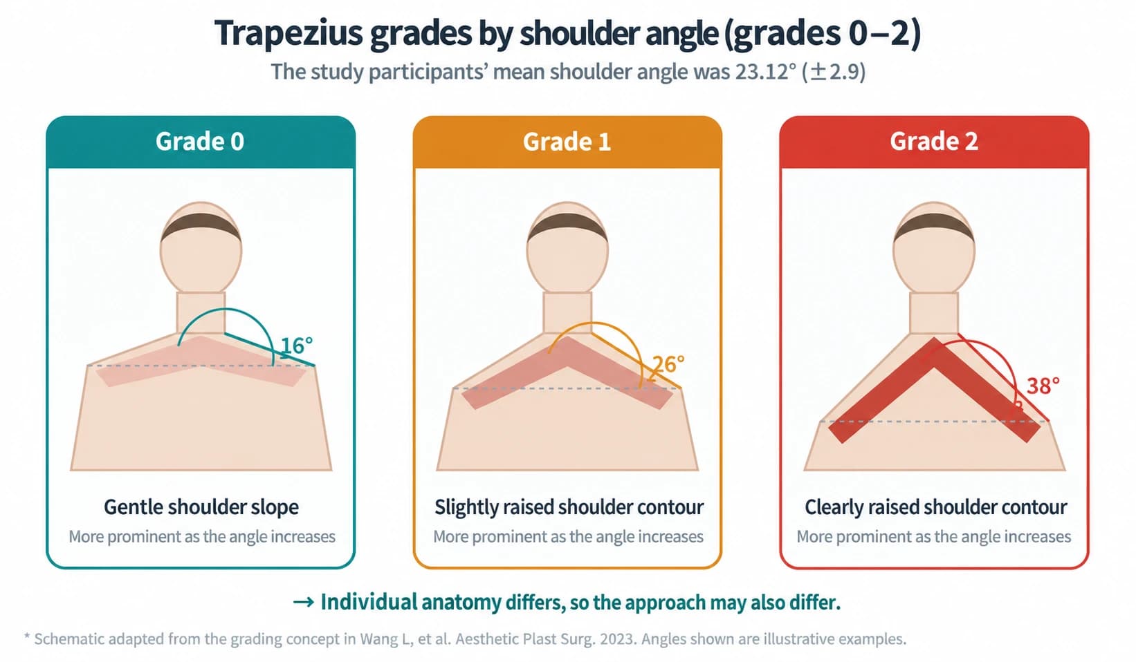 An English illustration comparing trapezius grades 0, 1, and 2 by shoulder angle