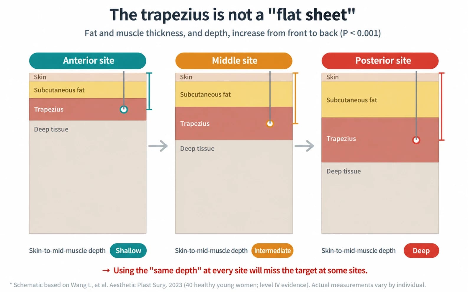 An English diagram comparing injection depth at three trapezius sites