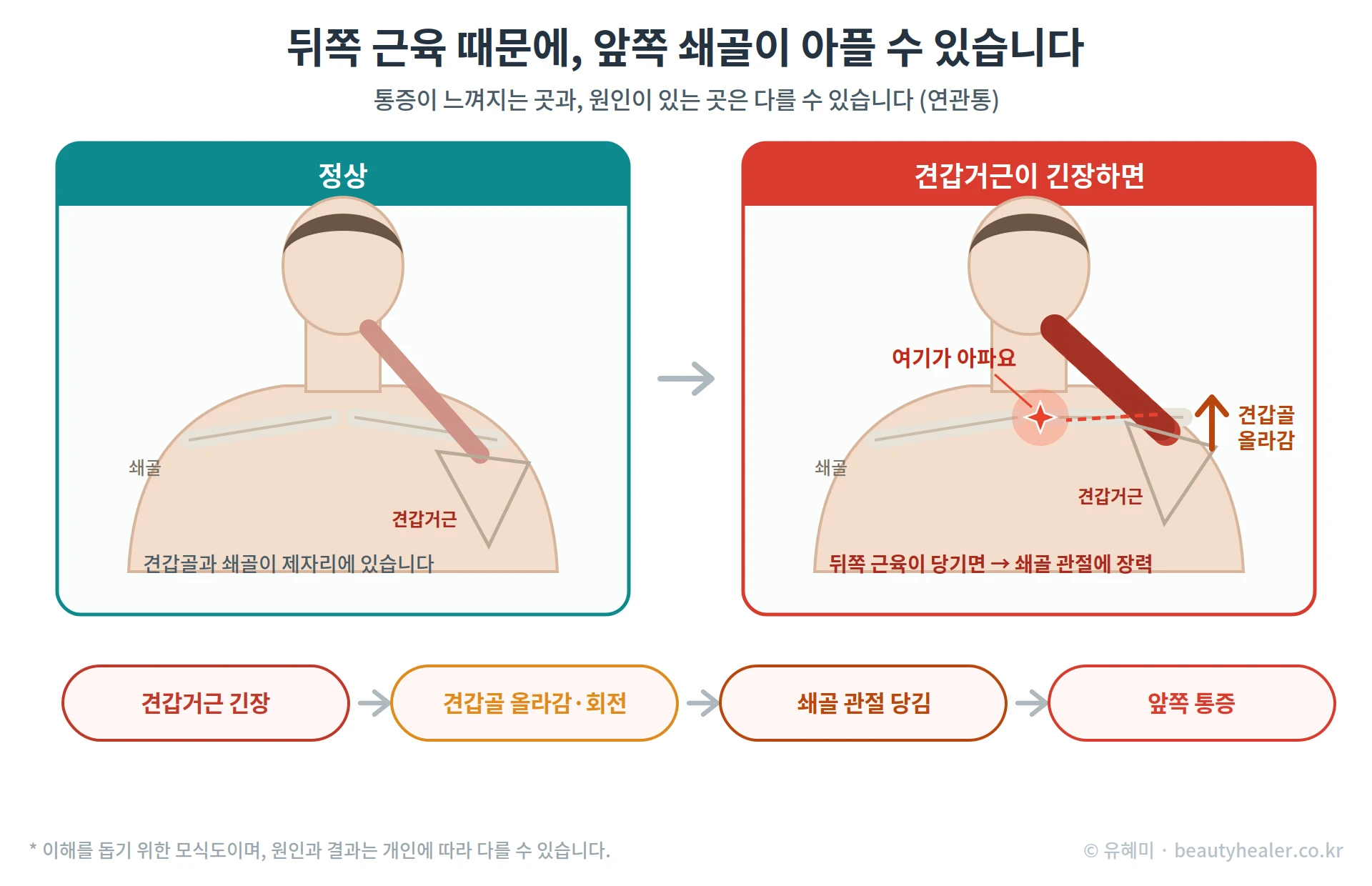 승모근과 견갑거근의 관계를 설명하는 도해