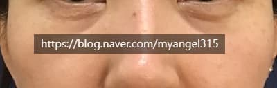 원문 개별 증례 사진 — 치료 경과·동의·재게시 승인 검수 대상