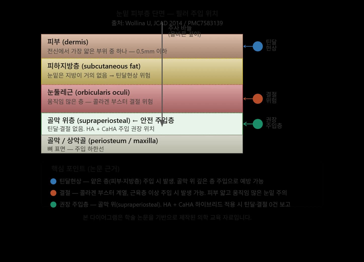 눈밑 필러 상담에서 고려할 점 — 원문 자료 3