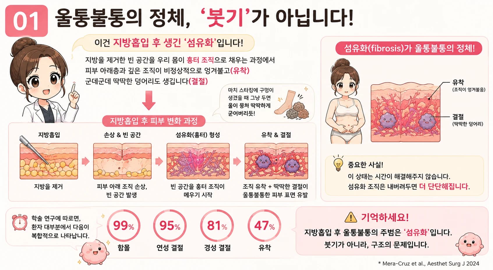 지방흡입 후 울퉁불퉁함을 평가하는 관점 — 원문 자료 3