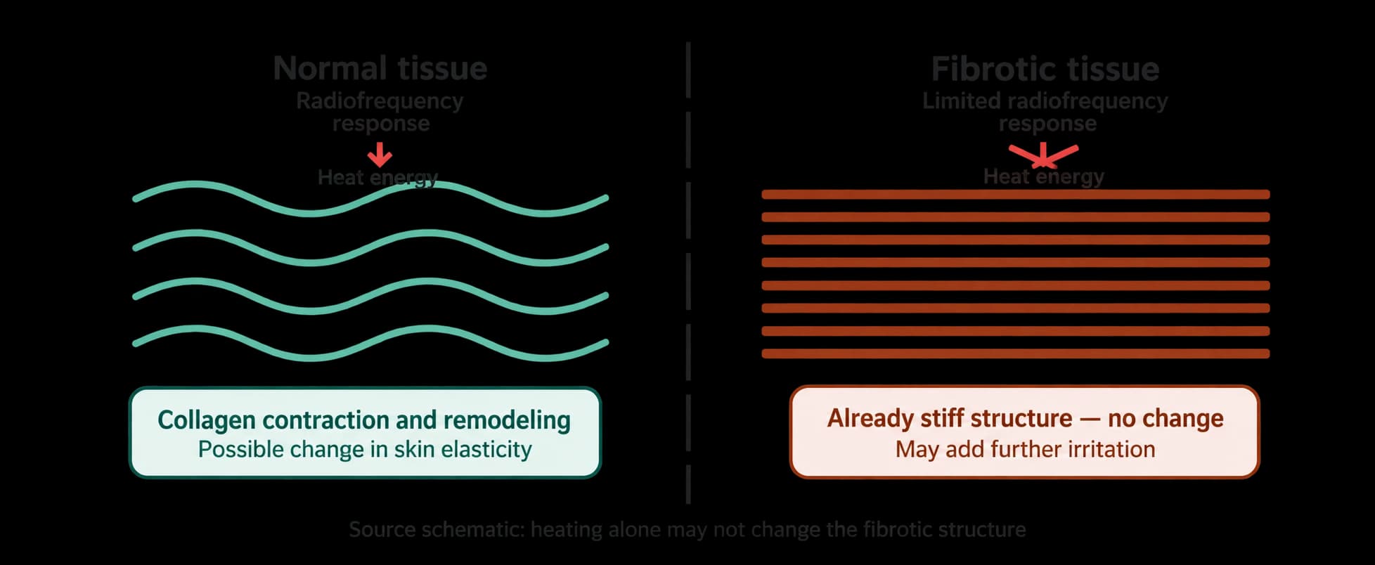 Assessing unevenness after liposuction — source material 4 — AI-assisted English adaptation; not an unedited medical original