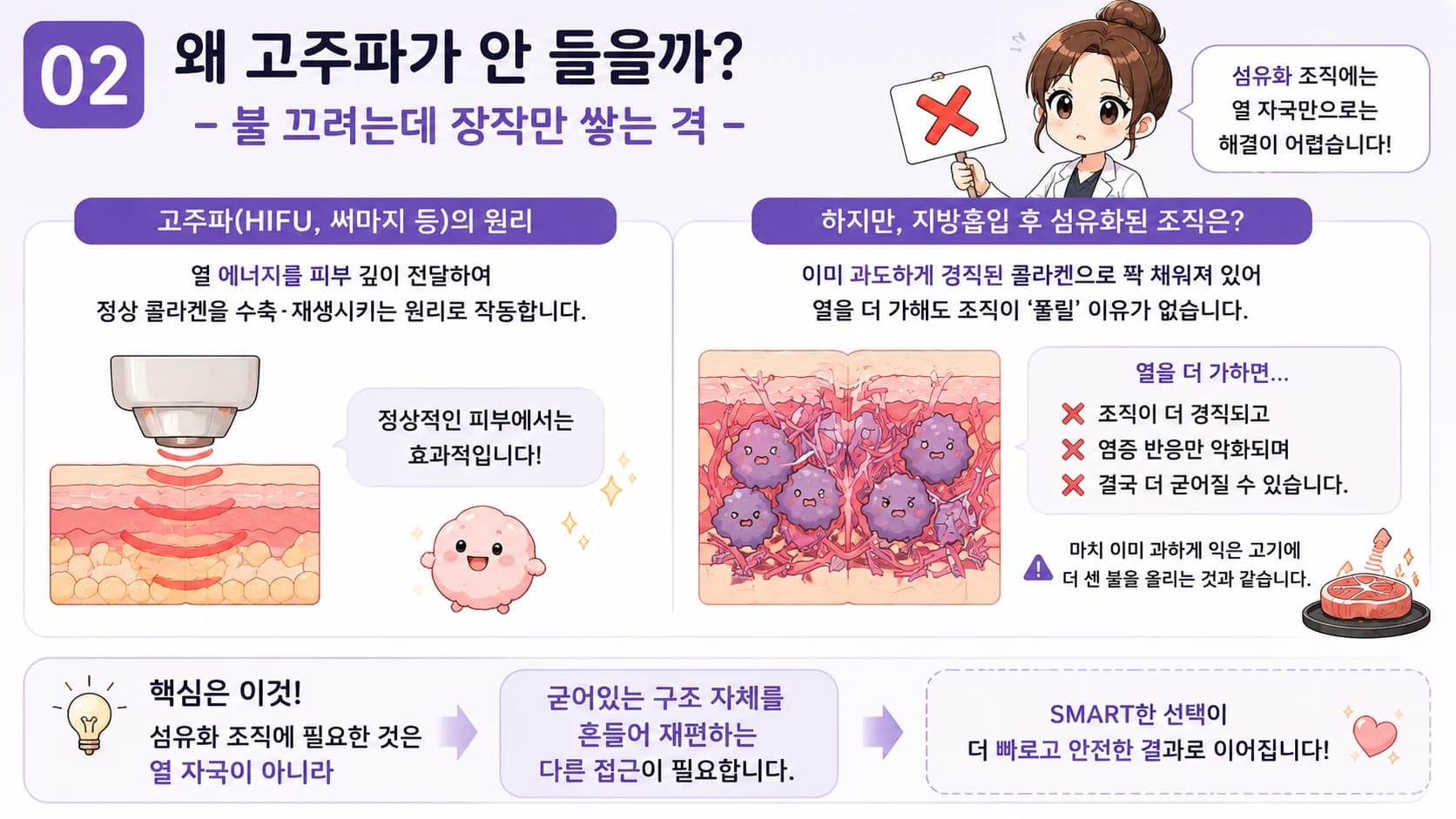 지방흡입 후 울퉁불퉁함을 평가하는 관점 — 원문 자료 5