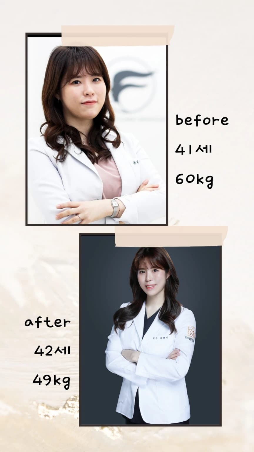 저자의 개인 전후사진